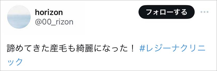 レジーナクリニック,脱毛,脱毛クリニック,良い口コミ