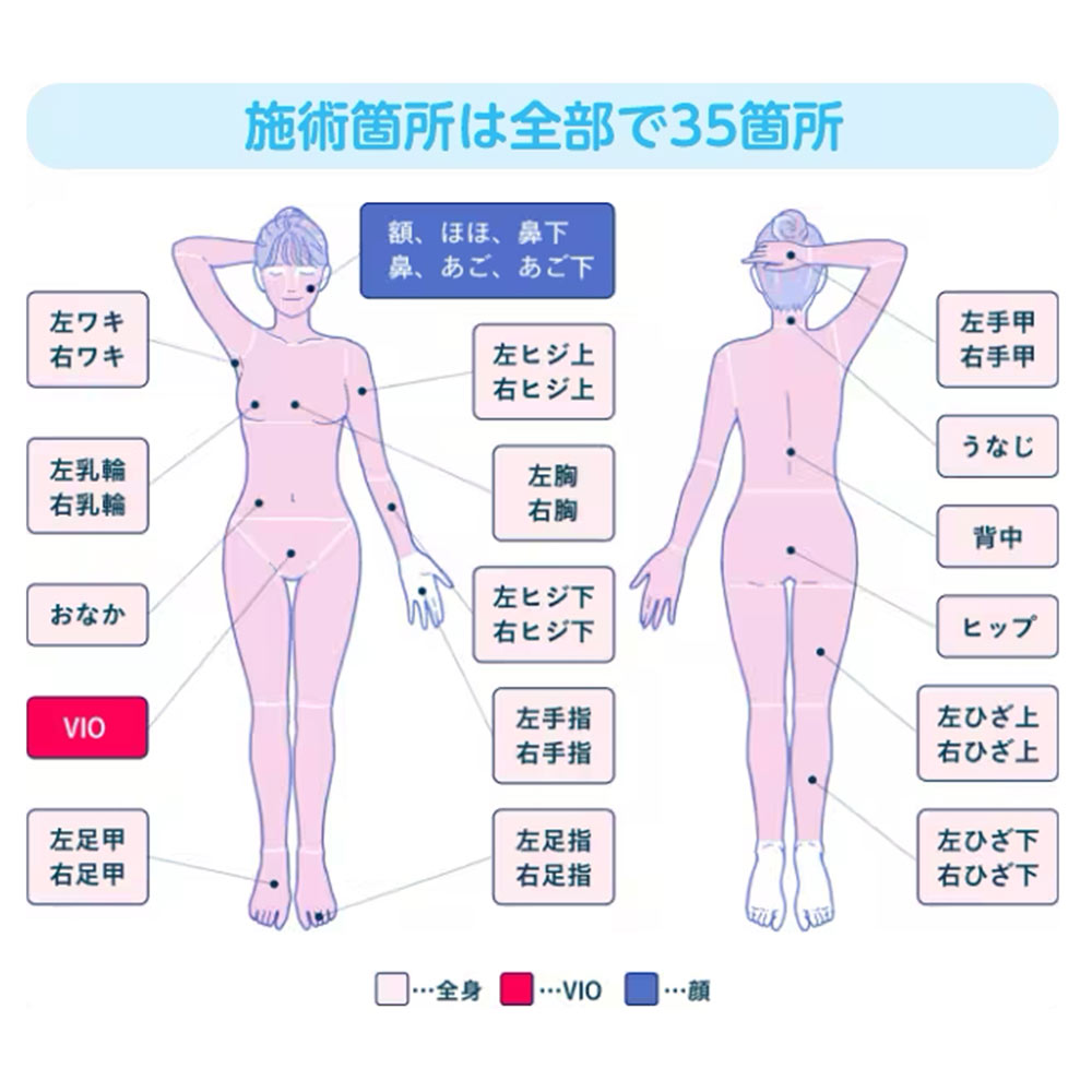 フレイアクリニック,脱毛,脱毛クリニック,良い口コミ