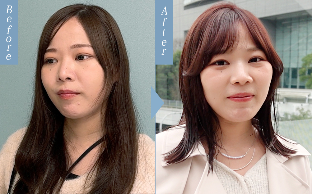ビフォーアフター事例3