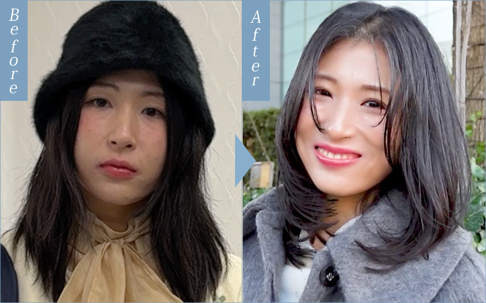 ビフォーアフター事例4
